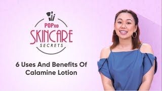 6 Uses And Benefits Of Calamine Lotion  POPxo Skincare Secrets [upl. by Adihsaar937]