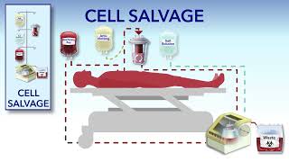 Cell Salvage and Hemodilution [upl. by Jago549]