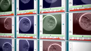 EmbryoScope® Timelapse System [upl. by Valery]