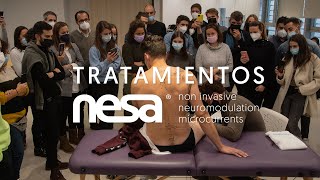 Tratamientos con la neuromodulación no invasiva NESA XSIGNAL® Razonamiento clínico y neuroanatomía [upl. by Bock630]