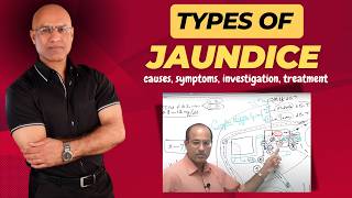 Types Of Jaundice  Causes Symptoms amp Treatment  Dr Najeeb [upl. by Marylee434]