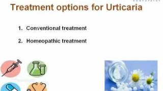 Urticaria Presentation Understanding Causes and Treatment of Urticaria or Hives [upl. by Barrett]