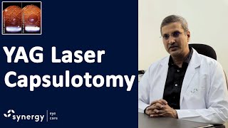 YAG Laser Capsulotomy after Cataract Surgery [upl. by Moreta971]