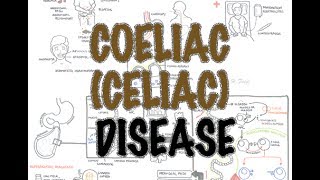 Coeliac Celiac Disease  Overview signs and symptoms pathophysiology diagnosis treatment [upl. by Ahsurej762]