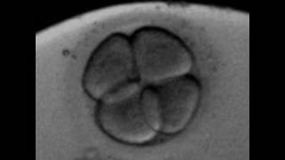 Rotation of the blastomeres at 4cells human embryoavi [upl. by Karlise]