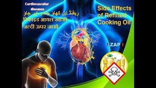 Side Effects of Refined Cooking Oil ریفنڈ ایل کھاؤ جلدی اپر جاؤ रिफाइंड आयल खाओ जल्दी ऊपर जाओ [upl. by Argent]