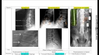 مراجعة سريعة لشرح جميع الأشعة Rapid Radiological Revision د محمود سويلم [upl. by Lemaj659]