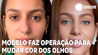 Modelo faz operação para mudar a cor dos olhos [upl. by Nyltyak939]