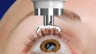 Unique DIATON Tonometry Through Eyelid  with Diaton Tonometer  Introduction  Description Part1 [upl. by Cadmarr]