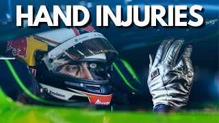 Formula E Hand Injuries  Why So Often [upl. by Auqinot]