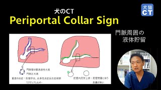 Periportal collar sign（7分50秒） [upl. by Resay809]