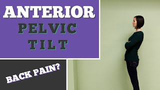 Is Anterior Pelvic Tilt Causing Your Back Pain [upl. by Annayrb]