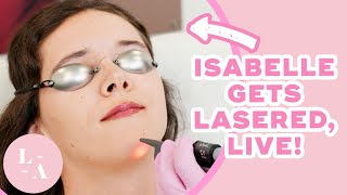 Laser Hair Removal Demo [upl. by Lesslie]