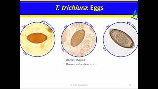 Trichuris trichiura Nematodes [upl. by Ellenrahc191]