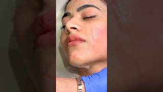 Get A Tightened Face Without Any Surgery  Sarayu Clinics hifu [upl. by Roberts]