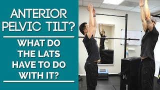 Tight Lats Anterior Pelvic Tilt Stretches To Fix The Anterior Pelvic Tilt [upl. by Aneehsram]