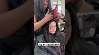 Alopeciawigs that slayWatch this stunning transformation alopeciawigs alopeciahairtransformation [upl. by Cowden]