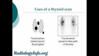 Your Radiologist Explains Thyroid Gland and Scan [upl. by Pahl]