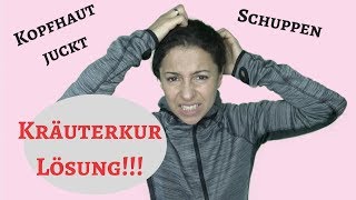 Kopfhaut juckt gereizt Schuppen  Einfache Lösung [upl. by Acinonrev]