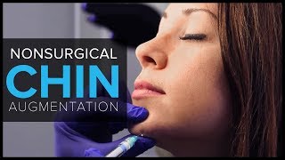 Non Surgical Chin Augmentation With Dermal Fillers at Mabrie Facial Institute [upl. by Fennie]