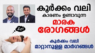 കൂർക്കം വലി ഉള്ളവർ സൂക്ഷിക്കുക  കൂർക്കം വലി മാറ്റാനുള്ള മാർഗങ്ങൾ  koorkkam vali ozhivakkan [upl. by Bedwell]