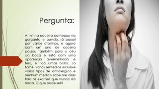 A coceira começou na garganta e ouvido agora também no céu da boca  Nada resolve  O que pode ser [upl. by Yenttihw]