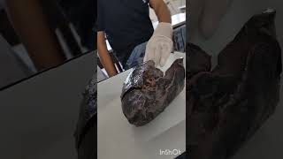 Lungs Dissection Anatomy Lab Msm Khanpurkalan Bams 1st proff Ayurveda [upl. by Iblehs598]