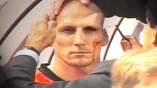 Jaap Stam eyebrow injury  EURO 2000 Netherlands v Czech Republic [upl. by Glennis463]