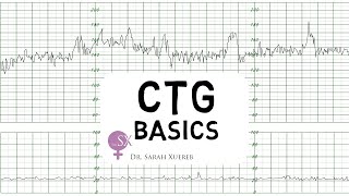 CTG Basics [upl. by Katerina]