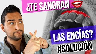 ¿Que es la GINGIVITIS ENCÍAS INFLAMADAS 👅 Y SANGRANTES 🦇 SOLUCION 2018 [upl. by Rudy474]