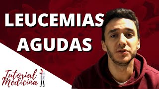 Leucemias Agudas Leucemia Mieloide e Leucemia Linfoide [upl. by Cirdes]