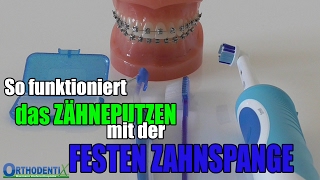 ZÄHNEPUTZEN mit der FESTEN ZAHNSPANGE  Orthodentix [upl. by Airamanna]