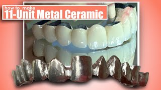 How to Make an 11Unit Metal Ceramic Restoration [upl. by Jablon784]