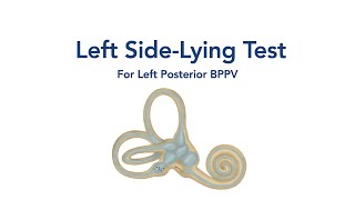 At Home Left Side lying Test for BPPV Vertigo [upl. by Ennaeel]