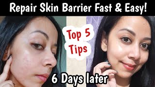 Top 5 Skincare Tips for Skin Barrier Repair skincare skinbarrier [upl. by Kurtzman]