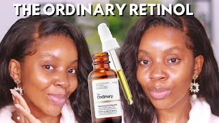 THE ORDINARY RETINOL 2 in squalene Review HOW TO CLEAR HYPERPIGMENTATION woc the Ordinary Skincare [upl. by Libre]