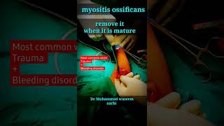 myositis ossificans  when to remove it [upl. by Bopp232]