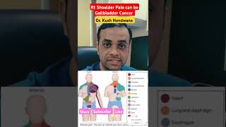 Why This Shoulder Pain Could Be Cancer ytshorts shorts [upl. by Poll]