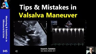 Tips amp Mistakes in Valsalva Maneuver [upl. by Adnilrev]