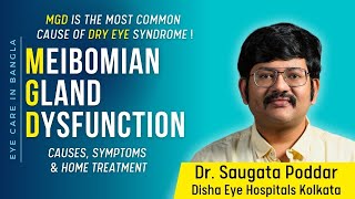 Meibomian Gland Dysfunction Causes Symptoms and remedy for dry eyes MGD by Dr Saugata Poddar [upl. by Tavi639]