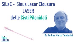 Trattamento Laser delle cisti pilonidali sinus pilonidalis  Dr Andrea Marco Tamburini [upl. by Dlorag32]