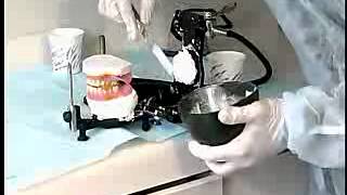 Complete Denture Procedure  21 CLINICAL REMOUNT AND OCCLUSAL REFINEMENTS [upl. by Dnalkrik]