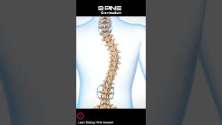 Scoliotic Spine Correction Short Video  spine shorts [upl. by Assirehs429]