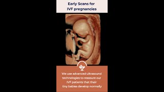 Early scans specially designed for IVF pregnancies [upl. by Nie]