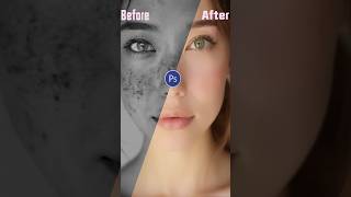 Adobe Photoshop 2025  ACNE Removing Technique ytshort shorts photoshoptutorial [upl. by Einohpets]