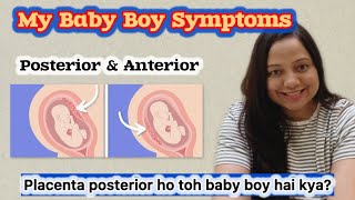 My Baby Boy Symptoms in pregnancy  Placenta Position se pata chalta hai baby ka gender [upl. by Schrick]