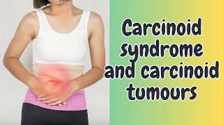 Carcinoid syndrome and carcinoid tumours [upl. by Hilar]