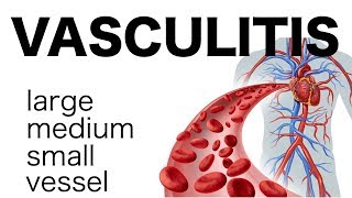 Vasculitis [upl. by Dlanger850]