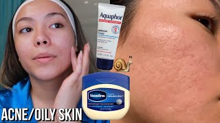 Viral Skincare Slugging using Vaseline and Aquaphor [upl. by Gnidleif]