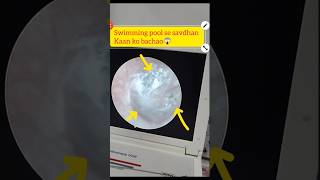 Swimming pool ear infectionbe aware🙏youtubeshorts eardischarge swimming [upl. by Dutch]